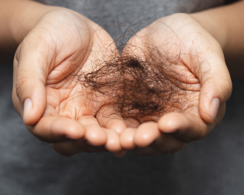 PRP for Hair Fall Control Mysore